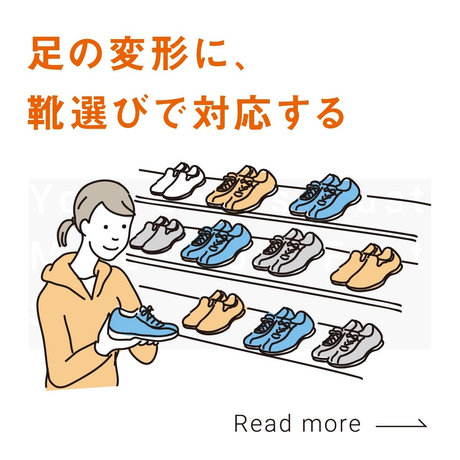 足の変形に、靴選びで対応する