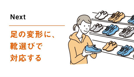 Next 足の変形に、靴選びで対応する